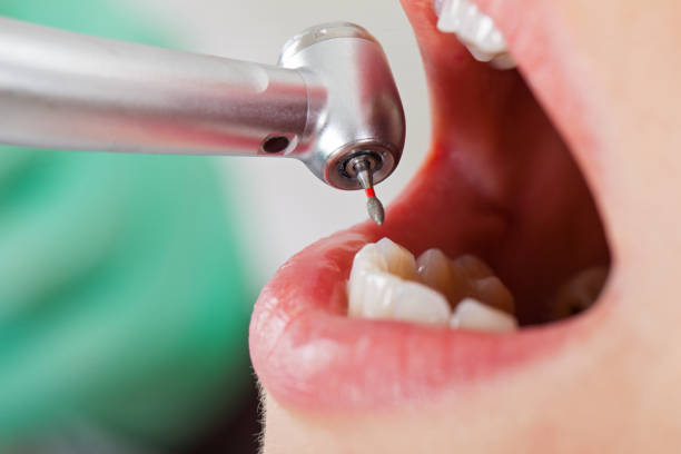 Best After-Hours Dental Care in Castlewood, VA